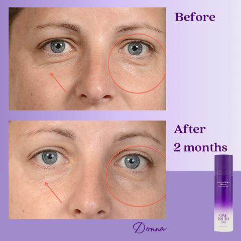 Before and after comparison of a woman’s face showing reduced wrinkles, smoother skin, and improved radiance after 1 month of using One Truth 818 Anti-Ageing Serum with TAM-818.