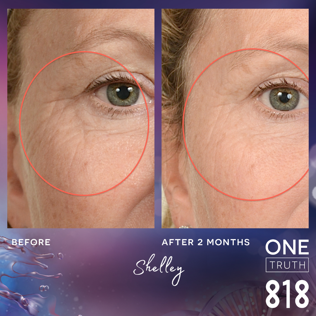 Before and Afters – One Truth 818 Australia