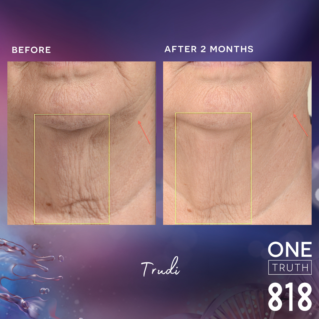 Before and Afters – One Truth 818 Australia